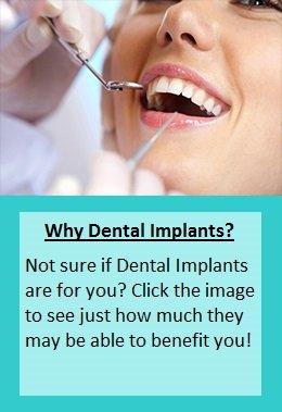 why-dental-implants