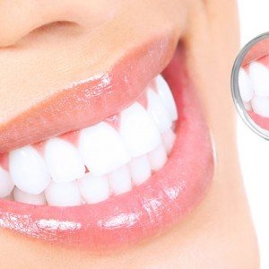 why dental implants