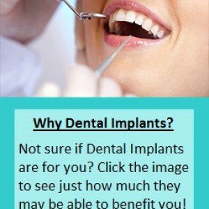 why-dental-implants