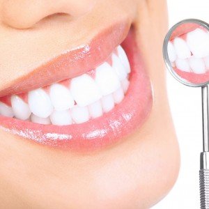 teeth-whitening-preston